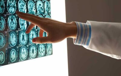 Traumatic Brain Injury Accidents in Texas