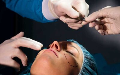 What Are Your Rights in a Botched Plastic Surgery Case?