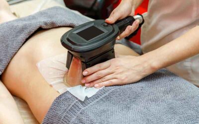 CoolSculpting Injury Claim FAQs